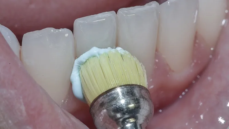 Clínico geral na Brasil Implantes